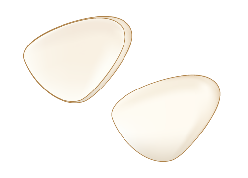 ジルコニアクラウン